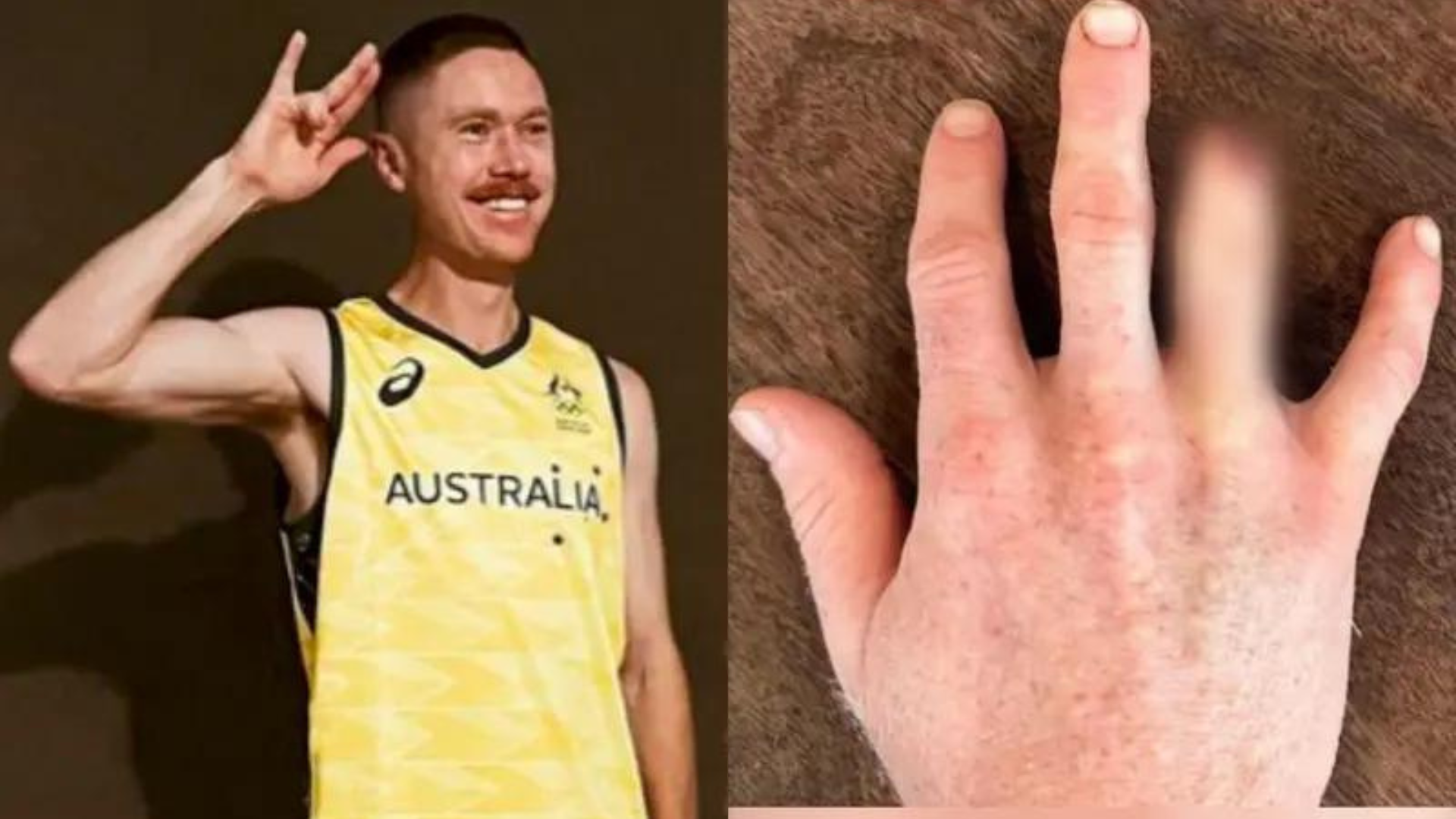 Decisión extrema: para no perderse los Juegos Olímpicos por una fractura en su dedo, deportista australiano decide amputárselo