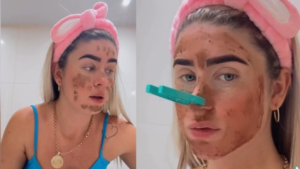 Influencer brasileña genera polémica en redes con esta extraña mascarilla de materia fecal supuestamente para prevenir el envejecimiento.