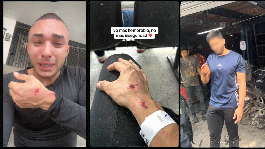 Homophobic attack in Medellín: Couple denounces assault